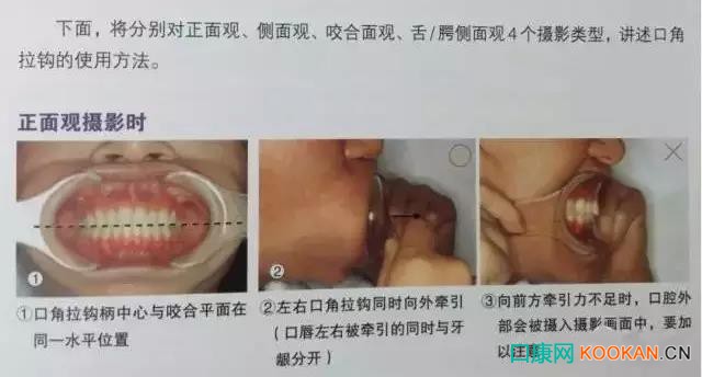 拍不好口腔照片怎么辦？這些口腔攝影方法與技巧請收好！