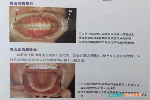 拍不好口腔照片怎么辦？這些口腔攝影方法與技巧請收好！