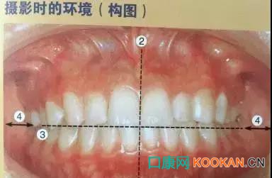 拍不好口腔照片怎么辦？這些口腔攝影方法與技巧請收好！