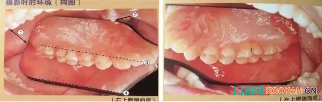 拍不好口腔照片怎么辦？這些口腔攝影方法與技巧請收好！