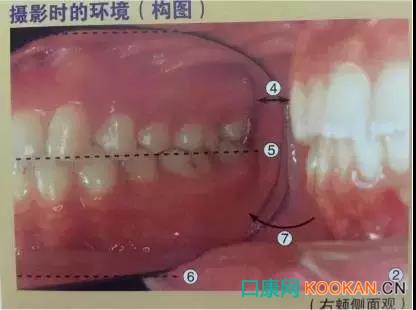 拍不好口腔照片怎么辦？這些口腔攝影方法與技巧請收好！