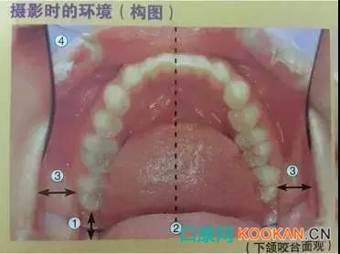拍不好口腔照片怎么辦？這些口腔攝影方法與技巧請收好！