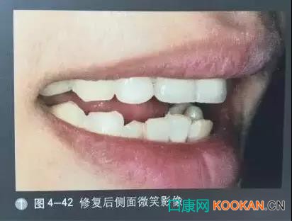 拍不好口腔照片怎么辦？這些口腔攝影方法與技巧請收好！