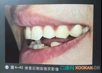 拍不好口腔照片怎么辦？這些口腔攝影方法與技巧請收好！