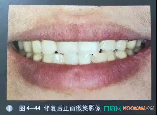 拍不好口腔照片怎么辦？這些口腔攝影方法與技巧請收好！